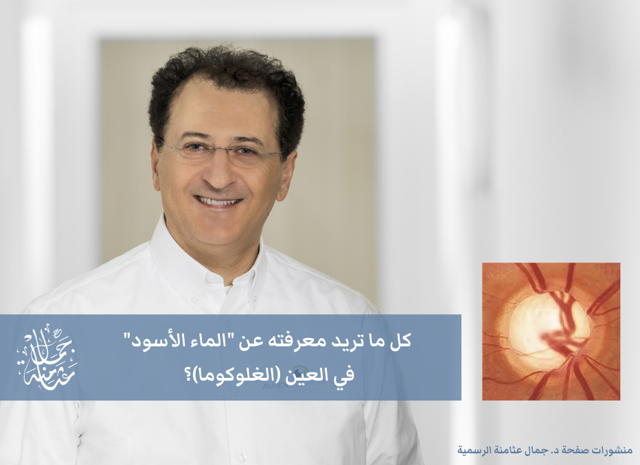 كل ما تريد معرفته عن الماء الأسود – الغلوكوما